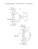 SYSTEMS AND METHODS FOR POSTERIOR DYNAMIC STABILIZATION OF THE SPINE diagram and image