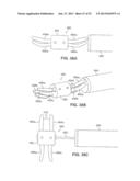 SYSTEMS AND METHODS FOR POSTERIOR DYNAMIC STABILIZATION OF THE SPINE diagram and image