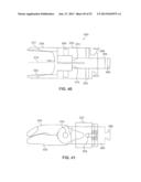 SYSTEMS AND METHODS FOR POSTERIOR DYNAMIC STABILIZATION OF THE SPINE diagram and image