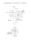 SYSTEMS AND METHODS FOR POSTERIOR DYNAMIC STABILIZATION OF THE SPINE diagram and image