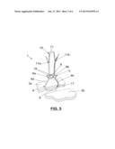 FIXATION DEVICE FOR THE FIXATION OF BONE FRAGMENTS diagram and image