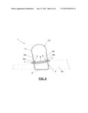 FIXATION DEVICE FOR THE FIXATION OF BONE FRAGMENTS diagram and image