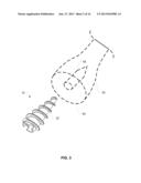 System and Method for Bone Fixation diagram and image