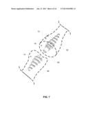 System and Method for Bone Fixation diagram and image