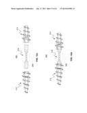 System and Method for Bone Fixation diagram and image