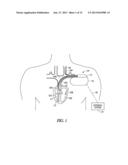 MANAGING CROSS THERAPY DELIVERY IN A MULTIPLE THERAPY IMPLANTABLE DEVICE diagram and image