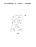 MANAGING CROSS THERAPY DELIVERY IN A MULTIPLE THERAPY IMPLANTABLE DEVICE diagram and image