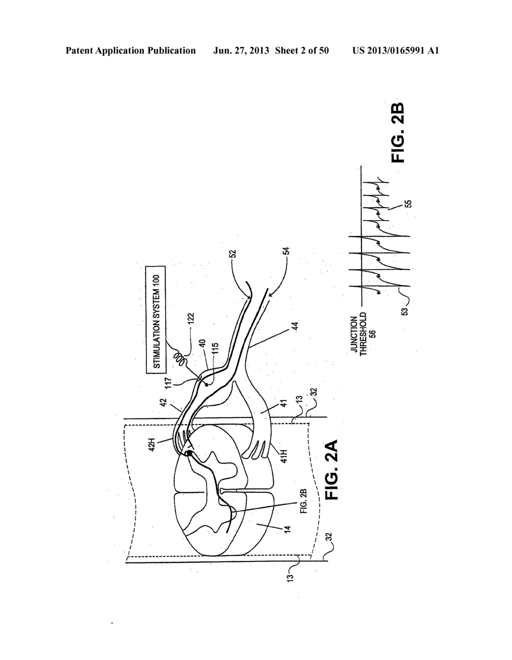 NEUROSTIMULATION METHODS AND SYSTEMS - diagram, schematic, and image 03