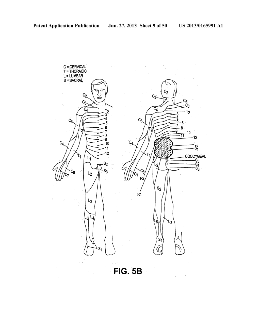 NEUROSTIMULATION METHODS AND SYSTEMS - diagram, schematic, and image 10