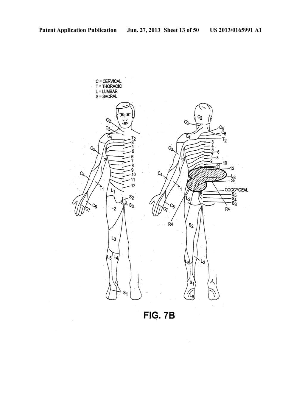 NEUROSTIMULATION METHODS AND SYSTEMS - diagram, schematic, and image 14