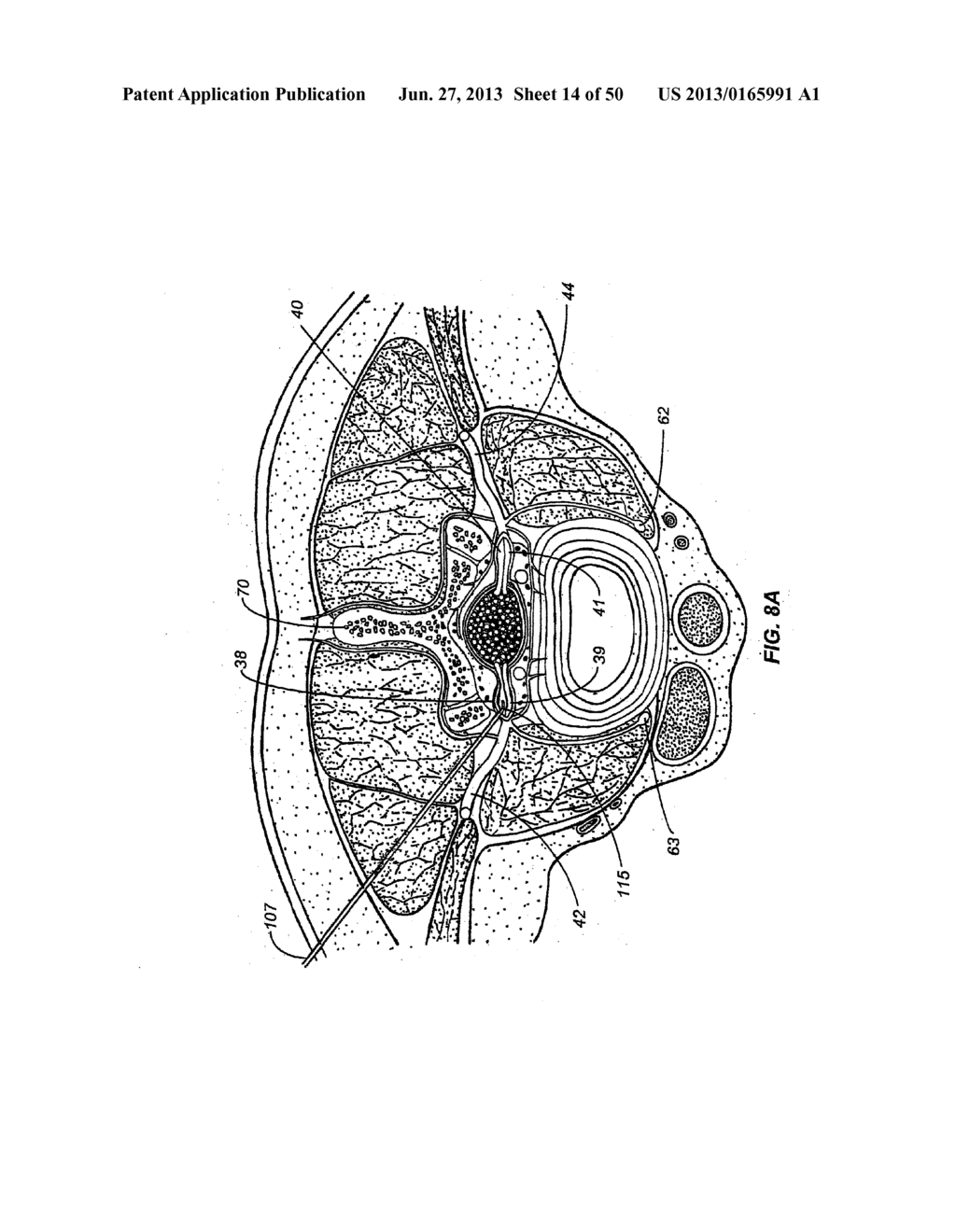 NEUROSTIMULATION METHODS AND SYSTEMS - diagram, schematic, and image 15