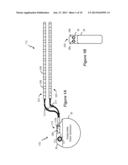 Multiple Telemetry and/or Charging Coil Configurations for an Implantable     Medical Device System diagram and image