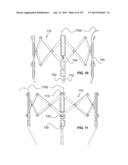 Actively Controllable Stent, Stent Graft, Heart Valve and Method of     Controlling Same diagram and image