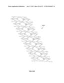 Actively Controllable Stent, Stent Graft, Heart Valve and Method of     Controlling Same diagram and image