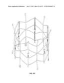 Actively Controllable Stent, Stent Graft, Heart Valve and Method of     Controlling Same diagram and image