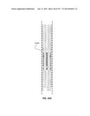 Actively Controllable Stent, Stent Graft, Heart Valve and Method of     Controlling Same diagram and image