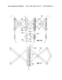 Actively Controllable Stent, Stent Graft, Heart Valve and Method of     Controlling Same diagram and image