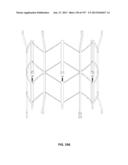 Actively Controllable Stent, Stent Graft, Heart Valve and Method of     Controlling Same diagram and image