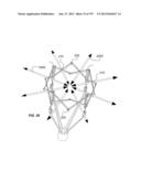 Actively Controllable Stent, Stent Graft, Heart Valve and Method of     Controlling Same diagram and image