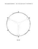 Actively Controllable Stent, Stent Graft, Heart Valve and Method of     Controlling Same diagram and image