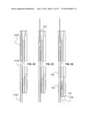 Actively Controllable Stent, Stent Graft, Heart Valve and Method of     Controlling Same diagram and image