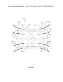 Actively Controllable Stent, Stent Graft, Heart Valve and Method of     Controlling Same diagram and image