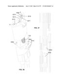 Actively Controllable Stent, Stent Graft, Heart Valve and Method of     Controlling Same diagram and image