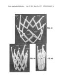 Actively Controllable Stent, Stent Graft, Heart Valve and Method of     Controlling Same diagram and image