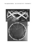 Actively Controllable Stent, Stent Graft, Heart Valve and Method of     Controlling Same diagram and image