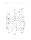 Actively Controllable Stent, Stent Graft, Heart Valve and Method of     Controlling Same diagram and image