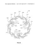 Actively Controllable Stent, Stent Graft, Heart Valve and Method of     Controlling Same diagram and image