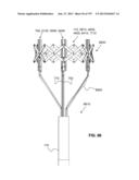 Actively Controllable Stent, Stent Graft, Heart Valve and Method of     Controlling Same diagram and image