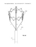 Actively Controllable Stent, Stent Graft, Heart Valve and Method of     Controlling Same diagram and image