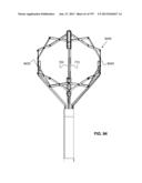 Actively Controllable Stent, Stent Graft, Heart Valve and Method of     Controlling Same diagram and image