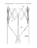 Actively Controllable Stent, Stent Graft, Heart Valve and Method of     Controlling Same diagram and image