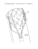 Actively Controllable Stent, Stent Graft, Heart Valve and Method of     Controlling Same diagram and image