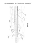 Actively Controllable Stent, Stent Graft, Heart Valve and Method of     Controlling Same diagram and image