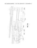 Actively Controllable Stent, Stent Graft, Heart Valve and Method of     Controlling Same diagram and image