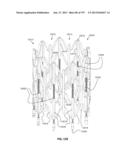 Actively Controllable Stent, Stent Graft, Heart Valve and Method of     Controlling Same diagram and image