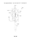 Actively Controllable Stent, Stent Graft, Heart Valve and Method of     Controlling Same diagram and image