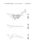 OSSEOUS IMPLANT AND METHODS OF ITS MAKING AND USE diagram and image