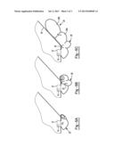 WRAP-AROUND AIRBAG DEVICE diagram and image