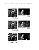 Imaging Arrangements and Methods Therefor diagram and image