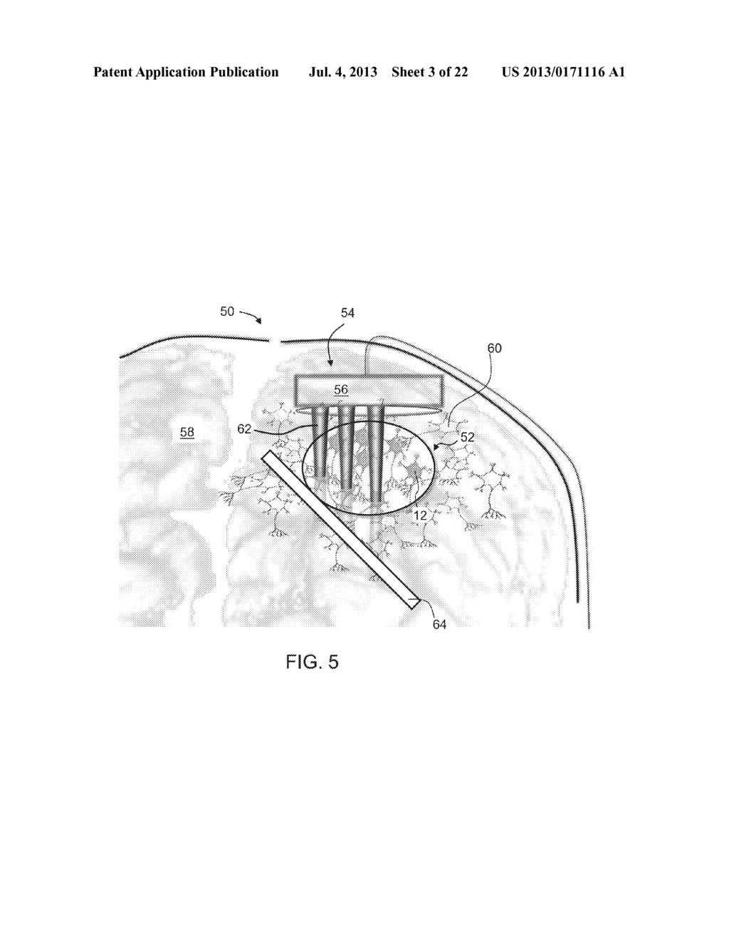 OPTICALLY SENSITIVE CELL NETWORK - diagram, schematic, and image 04