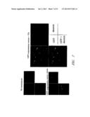 DRUG CARRIER AND DRUG CARRIER KIT FOR INHIBITING FIBROSIS diagram and image