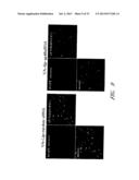 DRUG CARRIER AND DRUG CARRIER KIT FOR INHIBITING FIBROSIS diagram and image