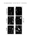 DRUG CARRIER AND DRUG CARRIER KIT FOR INHIBITING FIBROSIS diagram and image