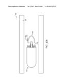 THERAPEUTIC AGENT PREPARATIONS FOR DELIVERY INTO A LUMEN OF THE INTESTINAL     TRACT USING A SWALLOWABLE DRUG DELIVERY DEVICE diagram and image