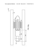 THERAPEUTIC AGENT PREPARATIONS FOR DELIVERY INTO A LUMEN OF THE INTESTINAL     TRACT USING A SWALLOWABLE DRUG DELIVERY DEVICE diagram and image