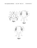 APPARATUS FOR MOULDING PLASTIC MICRO-PIECES BY ULTRASOUND diagram and image